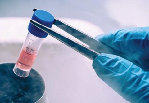 Liệu pháp tế bào CAR-T cho u lympho ác tính